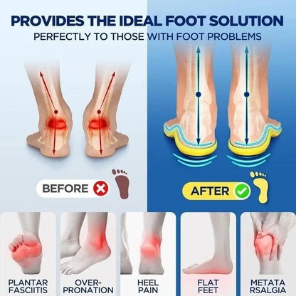 🔥High Quality Magnetic Relief Insoles